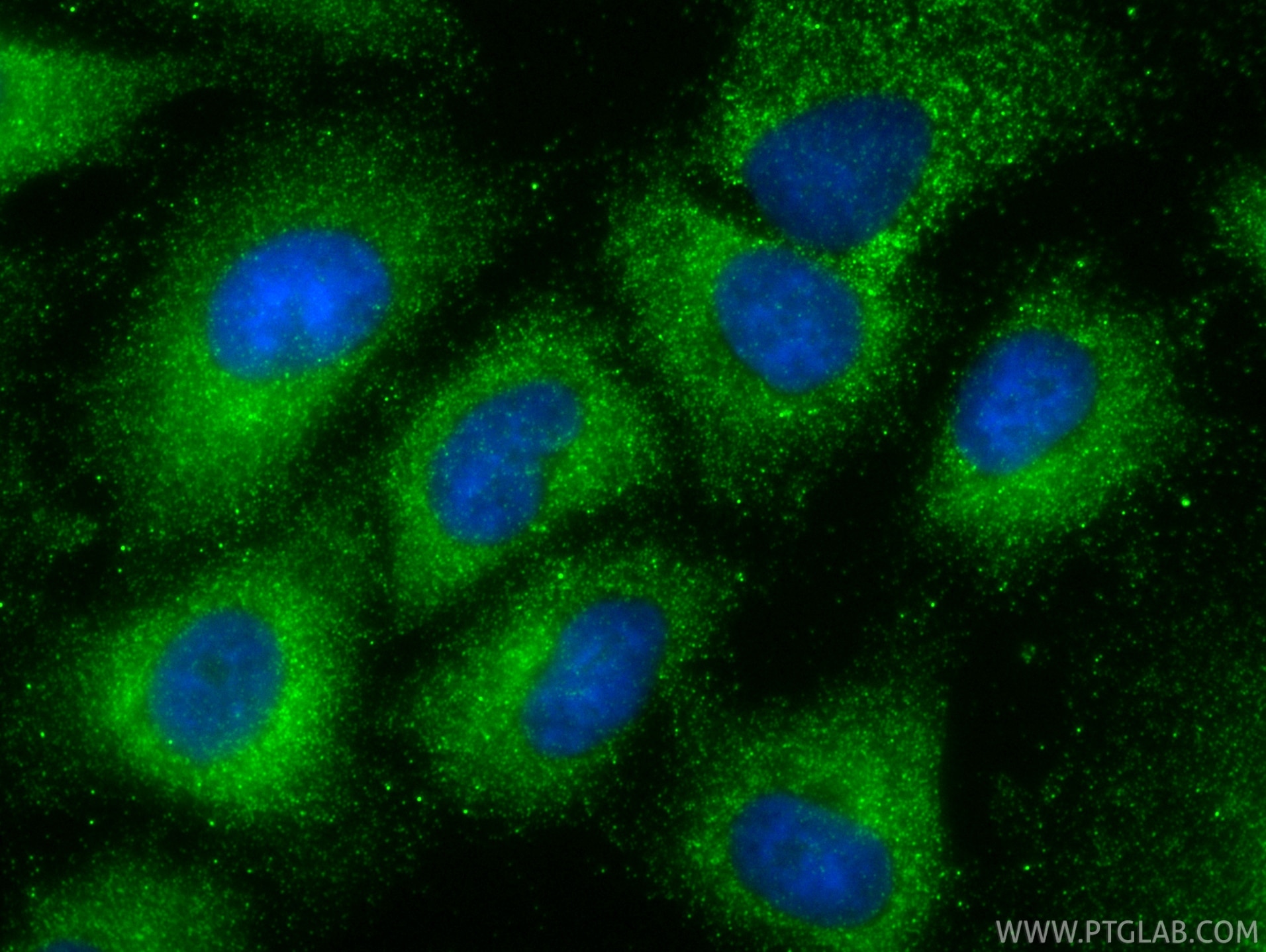IF Staining of A549 using 85374-1-RR Immunofluorescence (IF) / fluorescent staining of A549 cells using P4HA3 Recombinant monoclonal antibody (85374-1-RR)