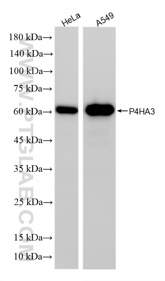 Various lysates were subjected to SDS PAGE followed by western blot with 85374-1-RR (P4HA3 antibody) at dilution of 1:2000 incubated at room temperature for 1.5 hours. This data was developed using the same antibody clone with 85374-1-PBS in a different storage buffer formulation. Western Blot (WB) analysis of various lysates using P4HA3 Recombinant monoclonal antibody (85374-1-RR)