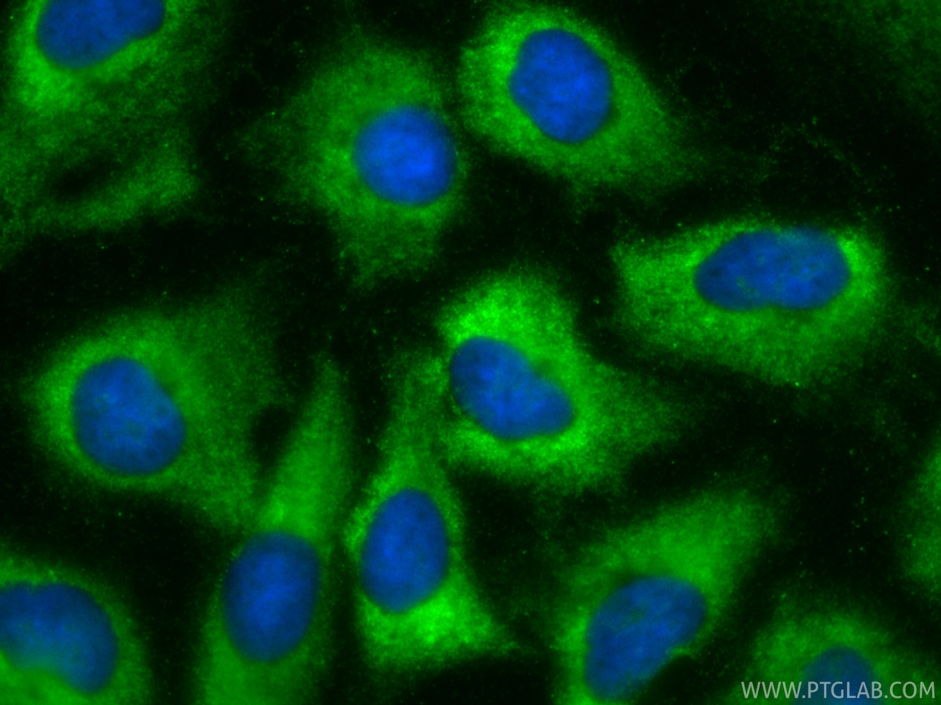 Immunofluorescence (IF) / fluorescent staining of A549 cells using CoraLite® Plus 488-conjugated P4HA3 Recombinant mo (CL488-85374)