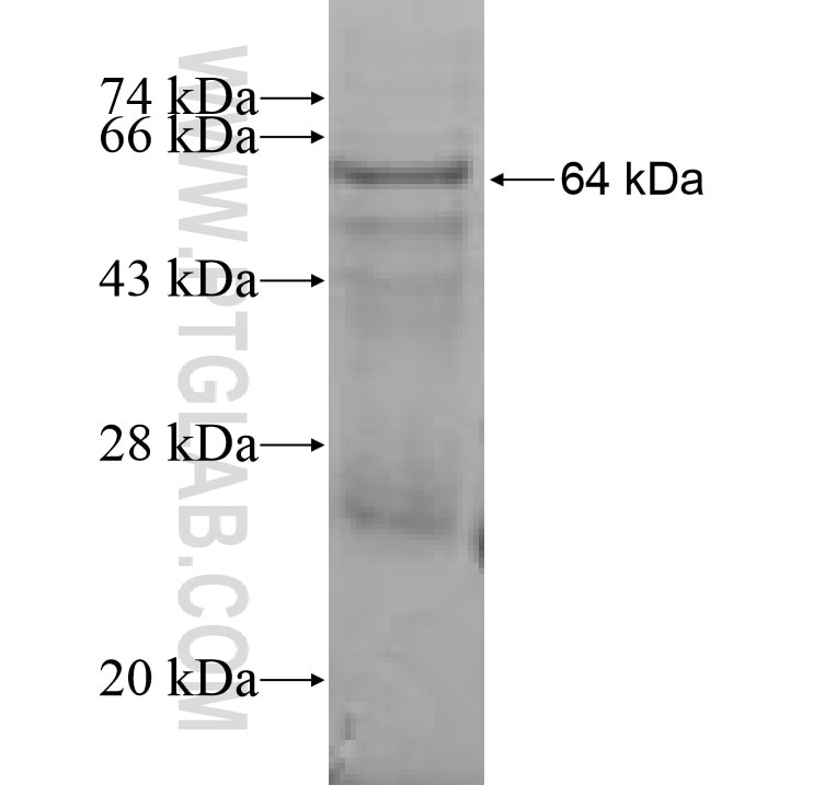 P4HTM fusion protein Ag9123 SDS-PAGE