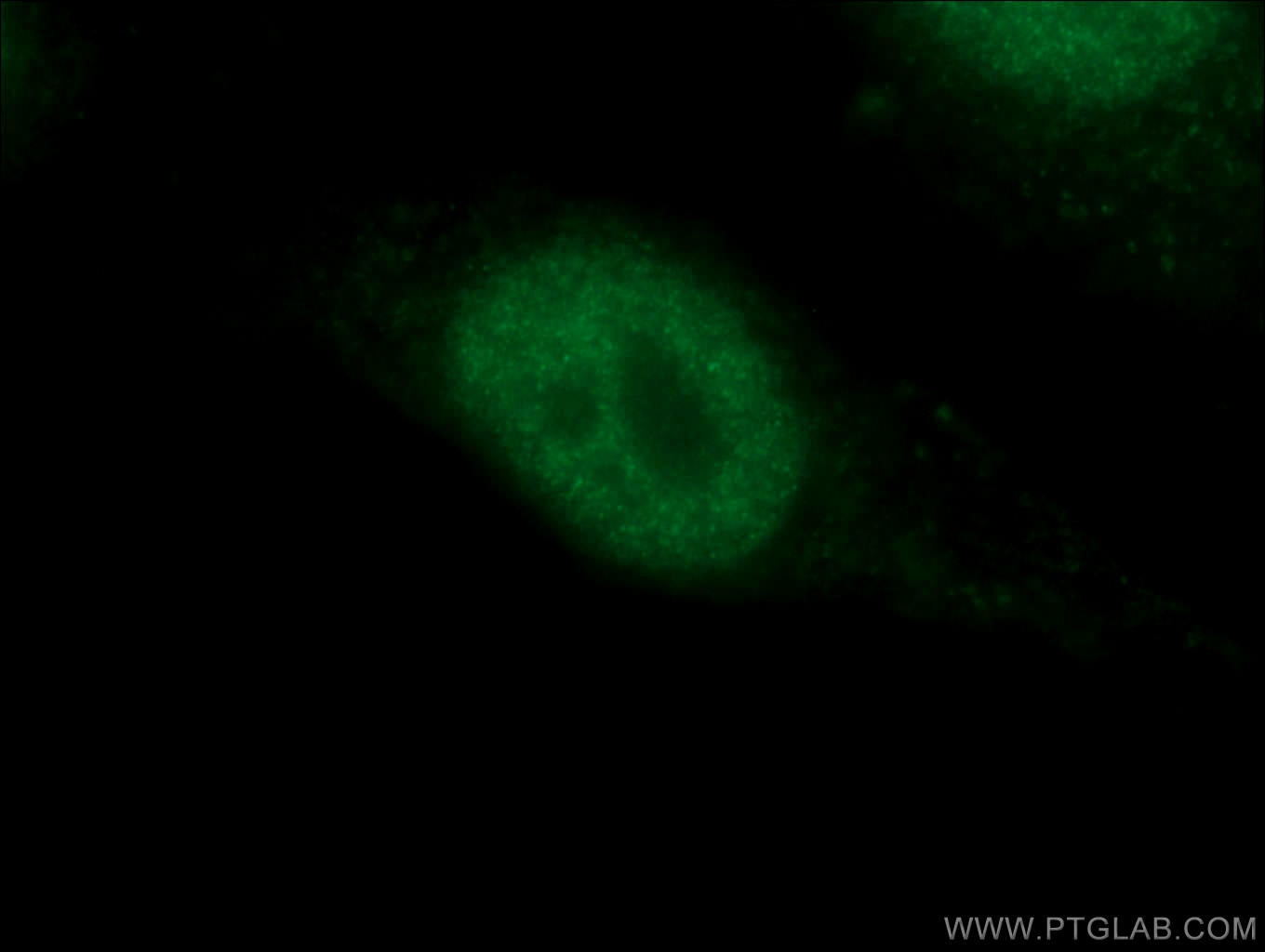Immunofluorescence (IF) / fluorescent staining of HepG2 cells using P53 Polyclonal antibody (10442-1-AP)