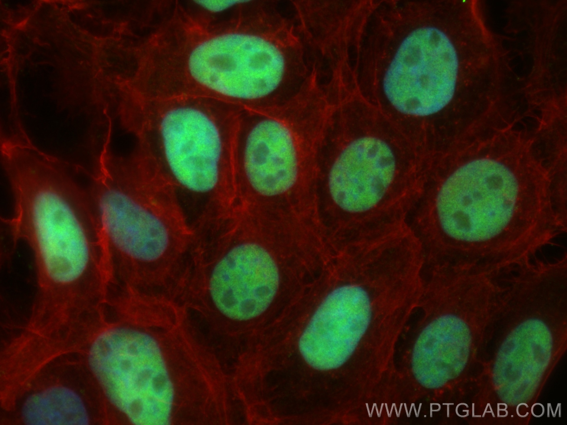 Immunofluorescence (IF) / fluorescent staining of A431 cells using P53 Polyclonal antibody (10442-1-AP)