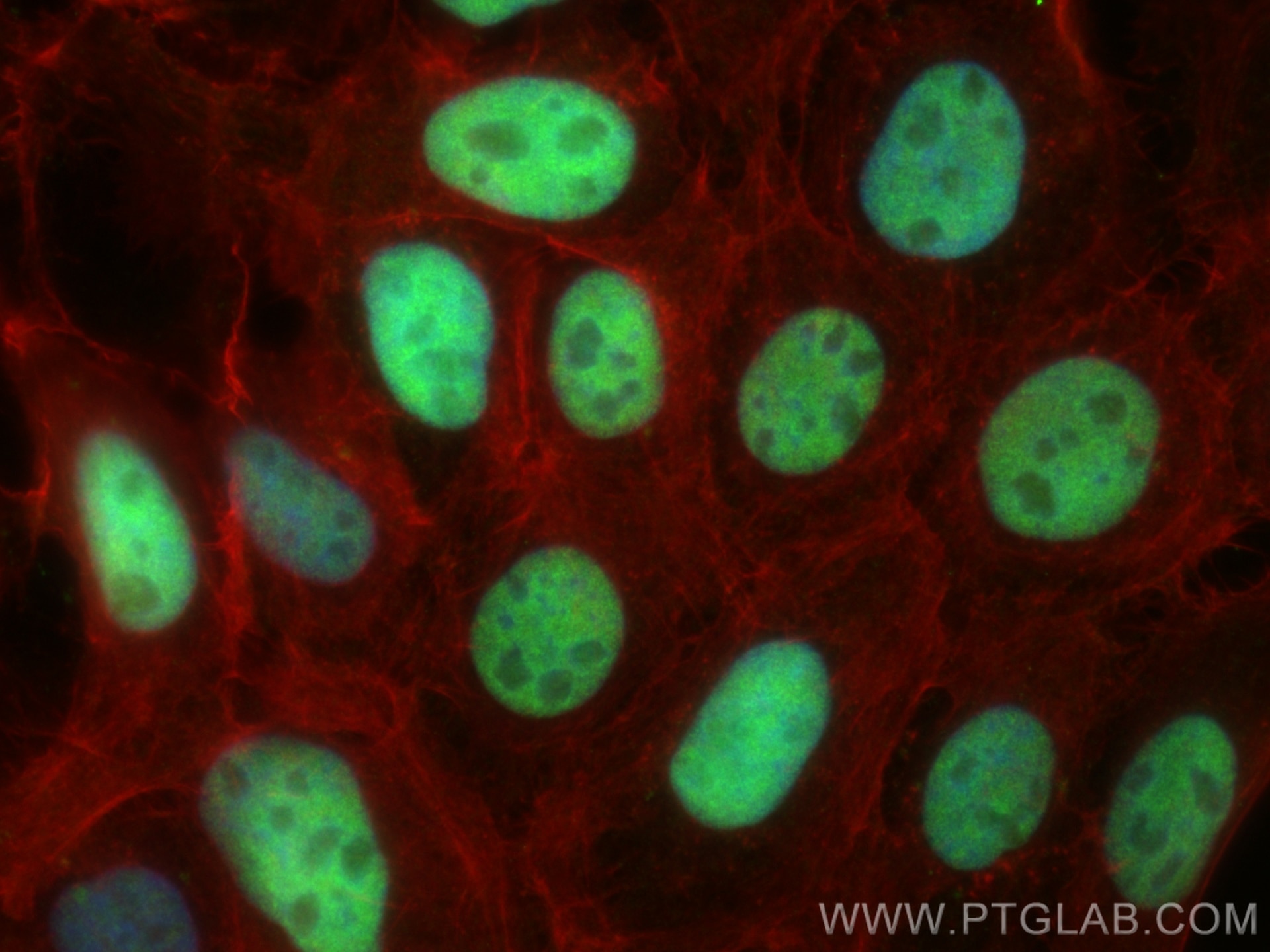 IF Staining of A431 using 10442-1-AP