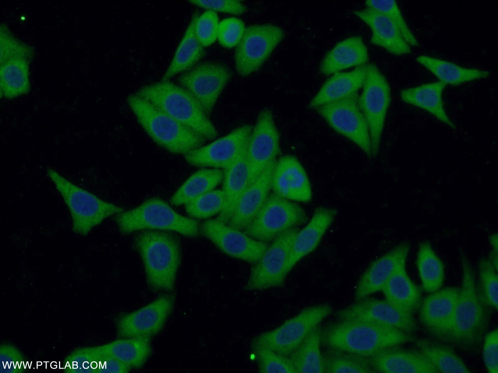 P53 Polyclonal antibody