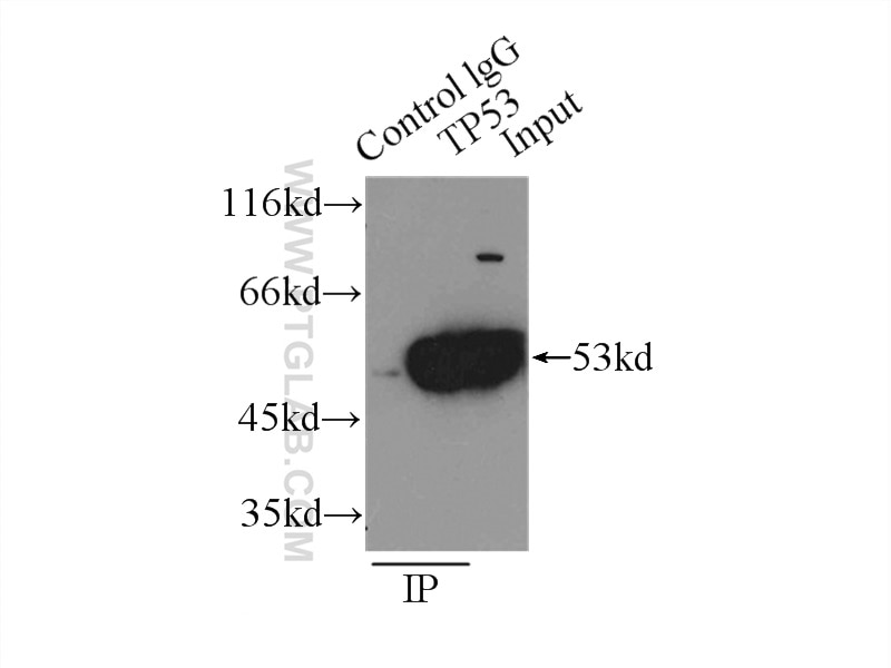 Immunoprecipitation (IP) experiment of A431 cells using P53 Polyclonal antibody (10442-1-AP)