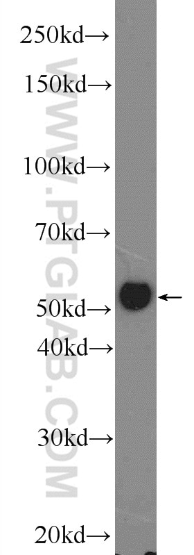 Western Blot (WB) analysis of rat colon tissue using P53 Polyclonal antibody (10442-1-AP)