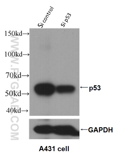 P53 Polyclonal antibody