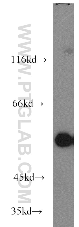 Western Blot (WB) analysis of A431 cells using P53 Polyclonal antibody (10442-1-AP)