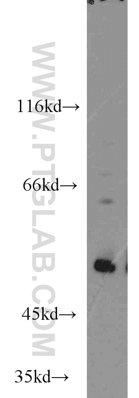 human P53 Polyclonal antibody