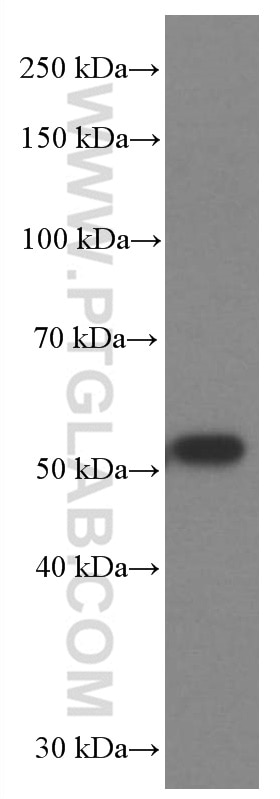 Western Blot (WB) analysis of A431 cells using P53 Monoclonal antibody (60283-1-Ig)
