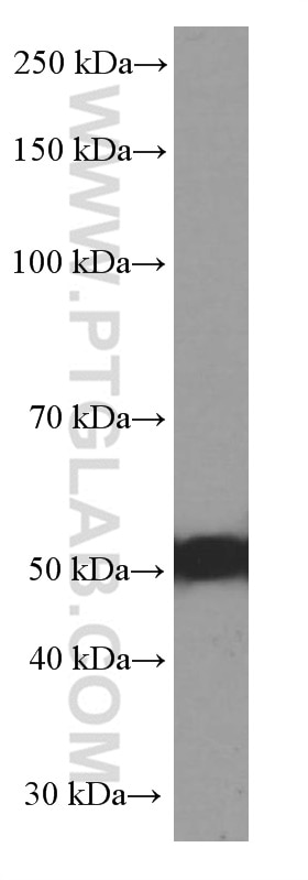 Western Blot (WB) analysis of COLO 320 cells using P53 Monoclonal antibody (60283-1-Ig)