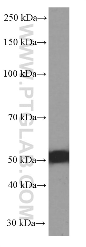 WB analysis of COLO 320 using 60283-1-Ig