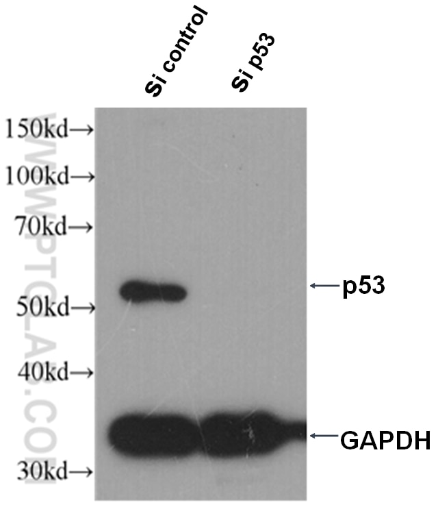 P53 Monoclonal antibody