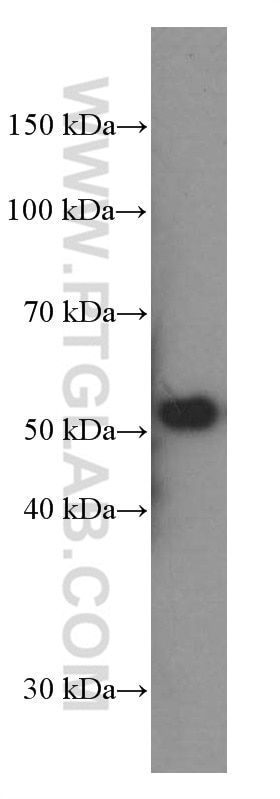P53 Monoclonal antibody