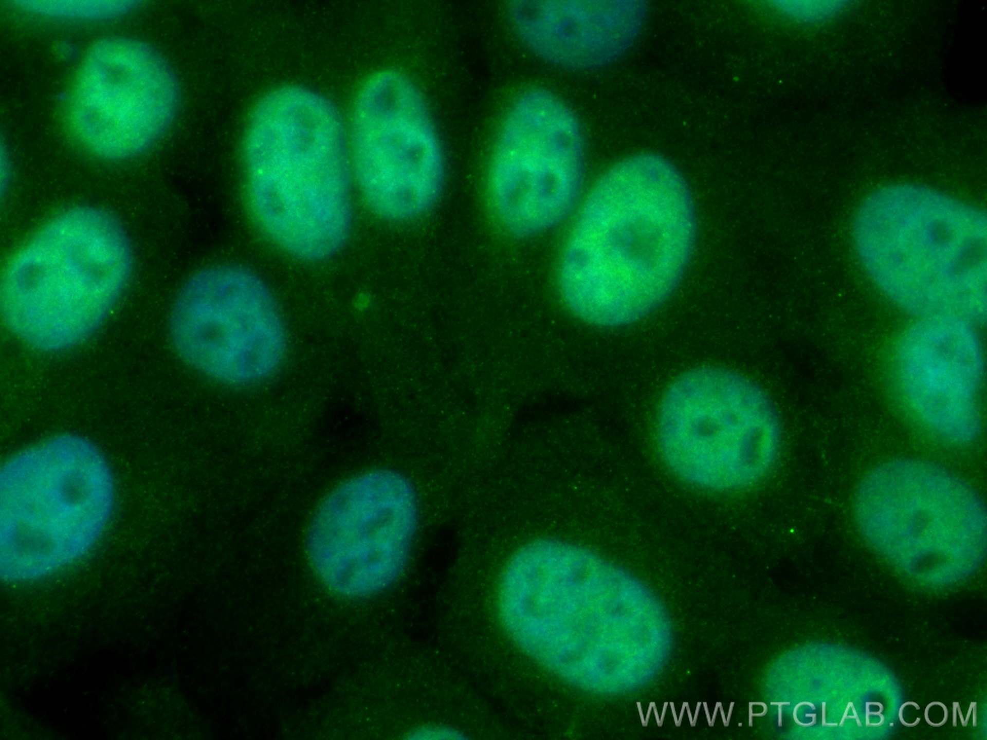 Immunofluorescence (IF) / fluorescent staining of A431 cells using P53 Monoclonal antibody (60283-2-Ig)