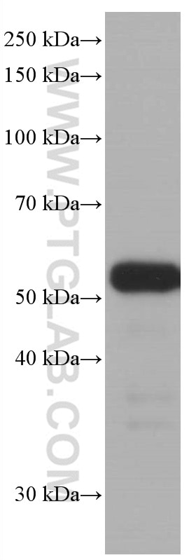 Western Blot (WB) analysis of A431 cells using P53 Monoclonal antibody (60283-2-Ig)