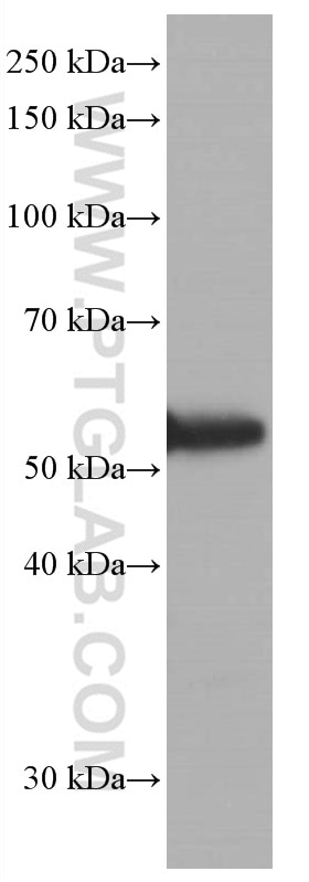 Western Blot (WB) analysis of COLO 320 cells using P53 Monoclonal antibody (60283-2-Ig)