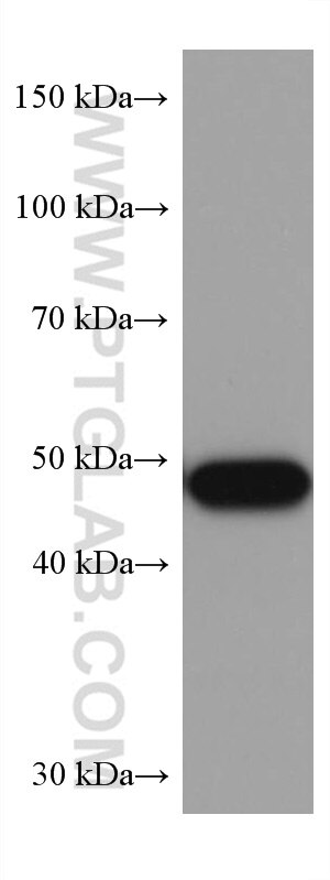 WB analysis of COLO 320 using 60283-2-Ig