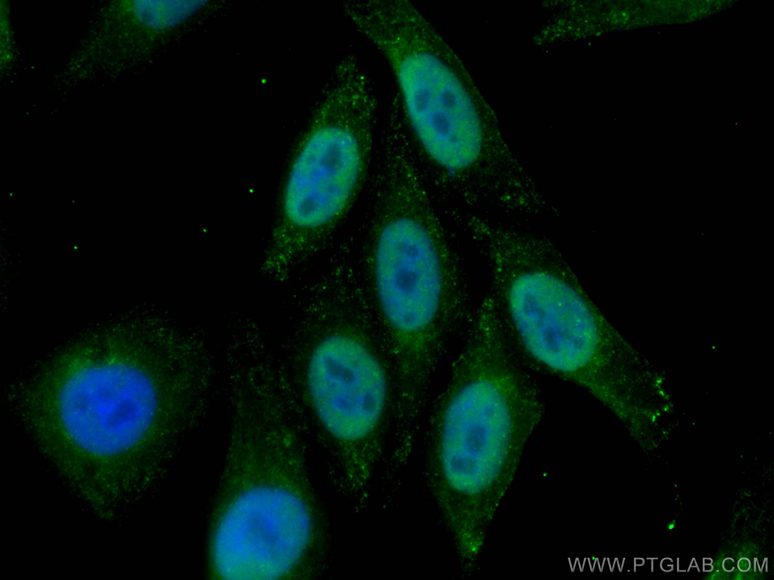 Immunofluorescence (IF) / fluorescent staining of HepG2 cells using P53 Recombinant antibody (80077-1-RR)