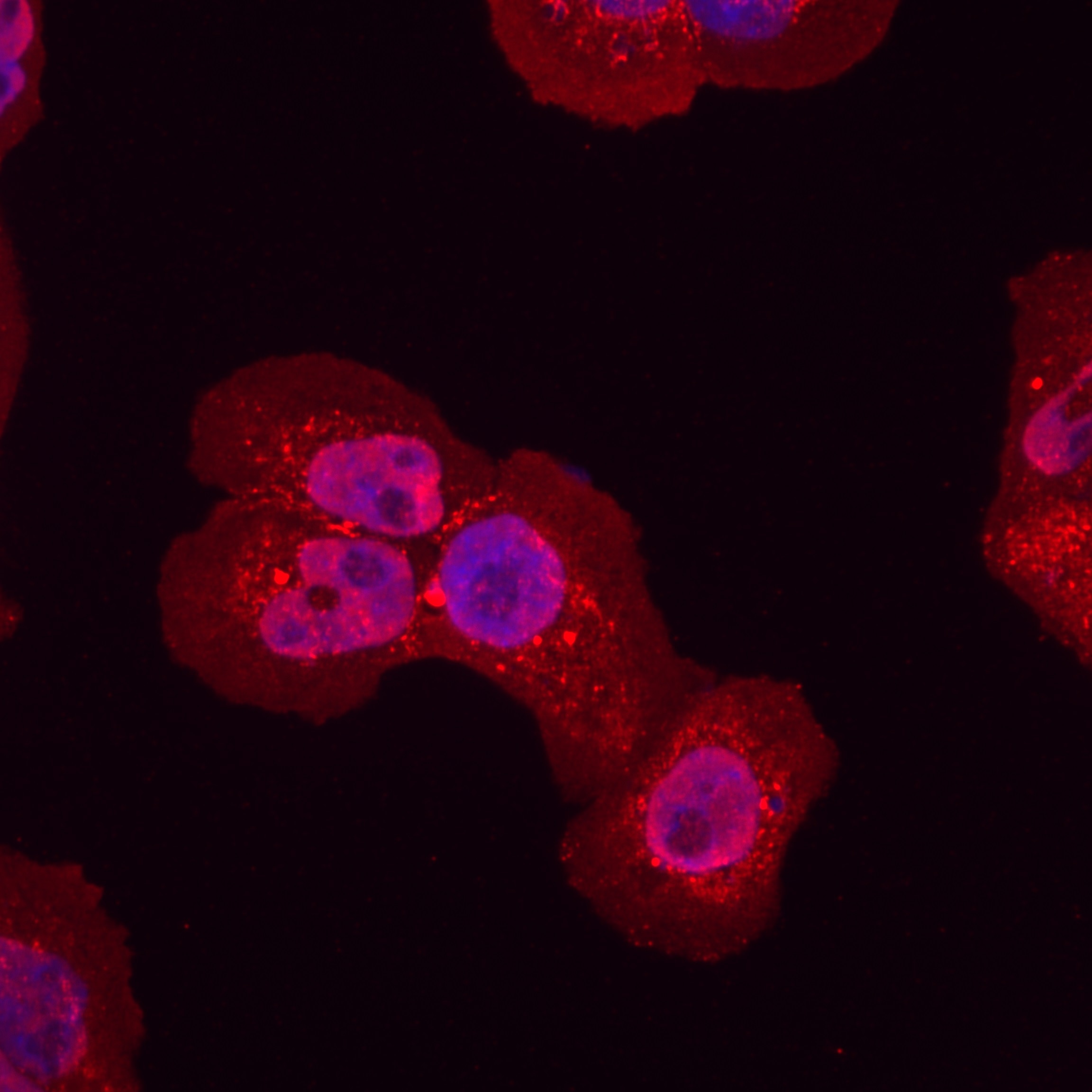 Immunofluorescence (IF) / fluorescent staining of A431 cells using P53 Recombinant antibody (80077-1-RR)