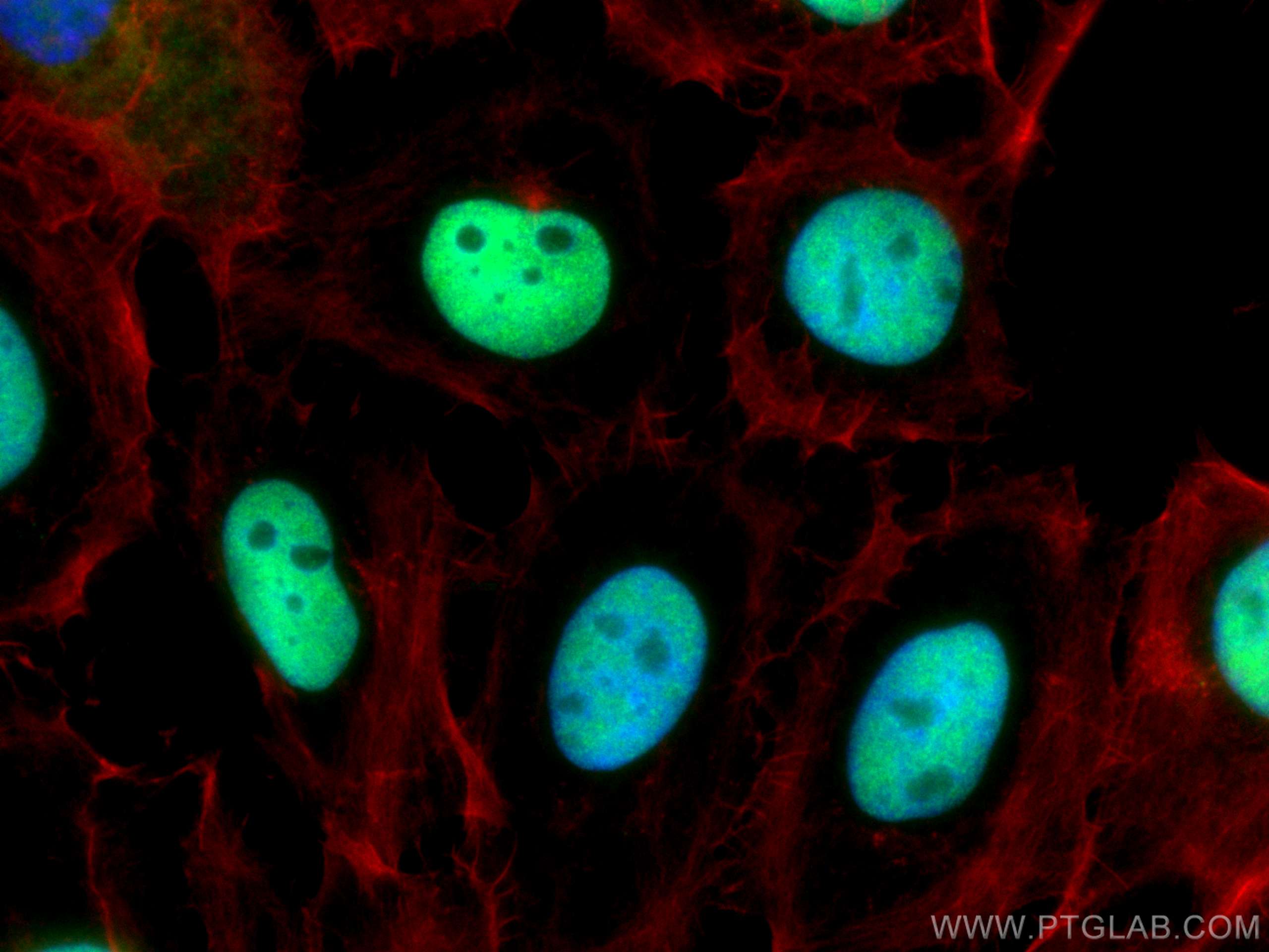 Immunofluorescence (IF) / fluorescent staining of A431 cells using CoraLite® Plus 488-conjugated P53 Polyclonal antib (CL488-10442)