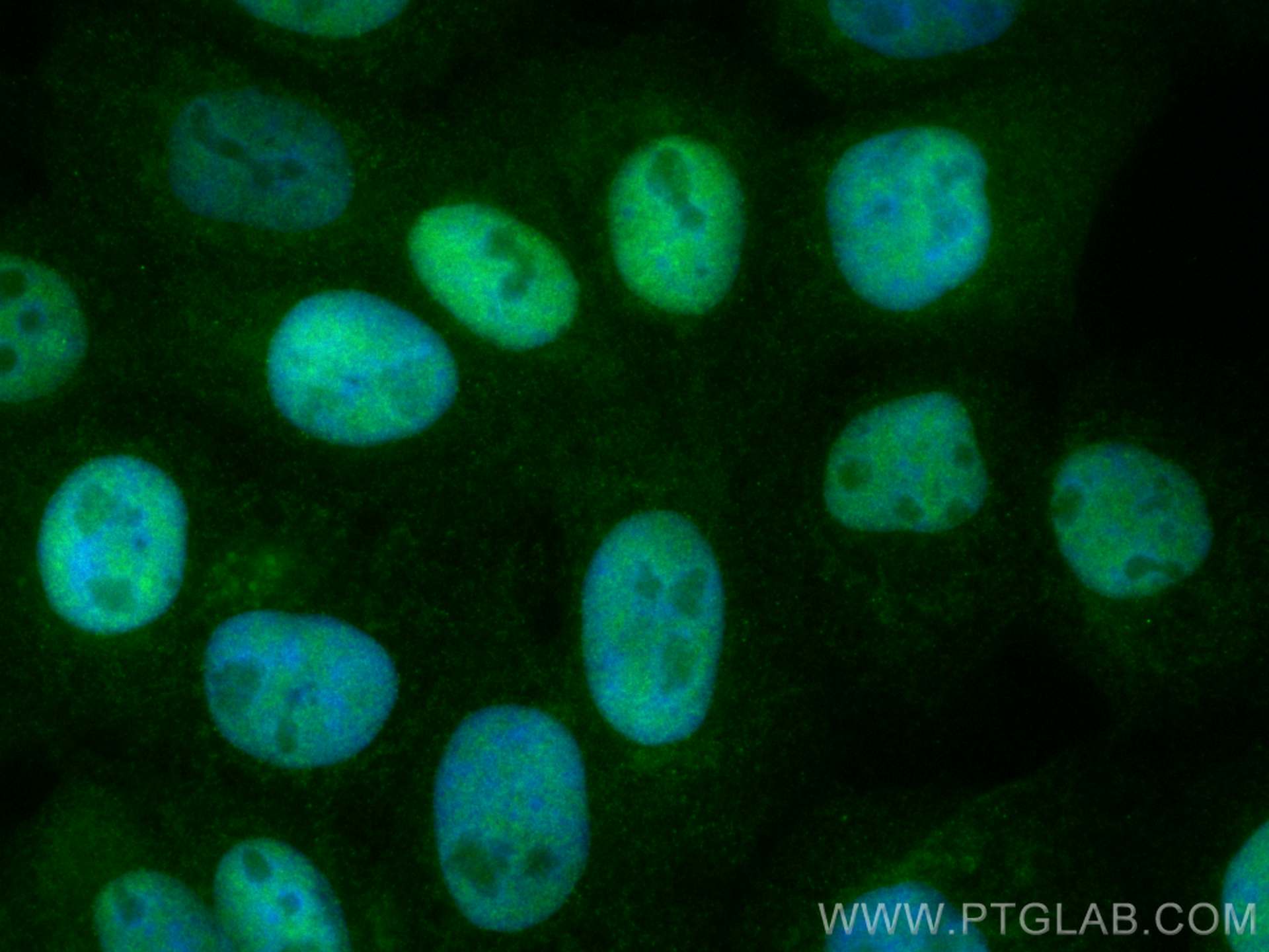 Immunofluorescence (IF) / fluorescent staining of A431 cells using CoraLite® Plus 488-conjugated P53 Monoclonal antib (CL488-60283)