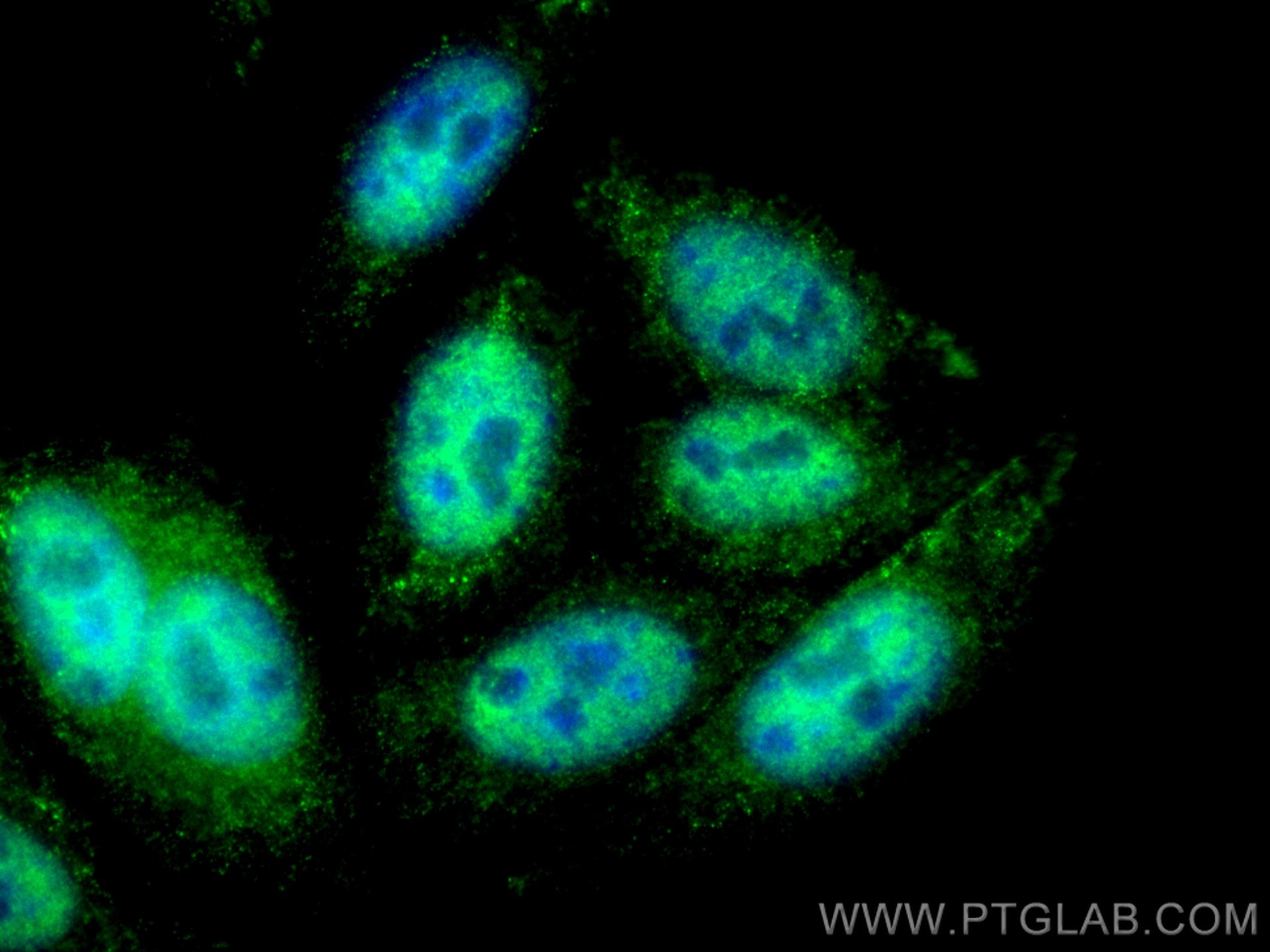 Immunofluorescence (IF) / fluorescent staining of HepG2 cells using CoraLite® Plus 488-conjugated P53 Recombinant anti (CL488-80077)
