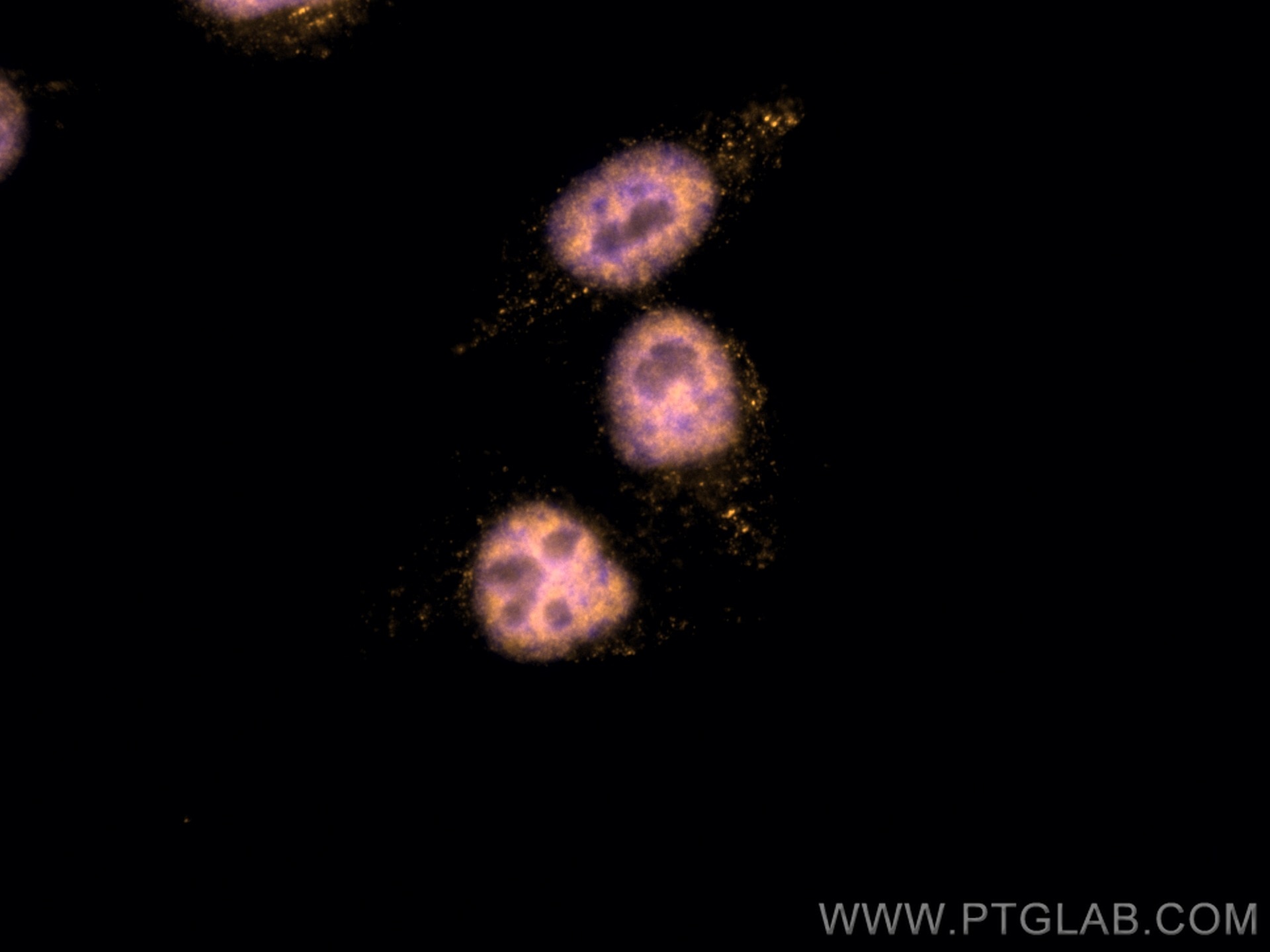 Immunofluorescence (IF) / fluorescent staining of HepG2 cells using CoraLite®555-conjugated P53 Recombinant antibody (CL555-80077)