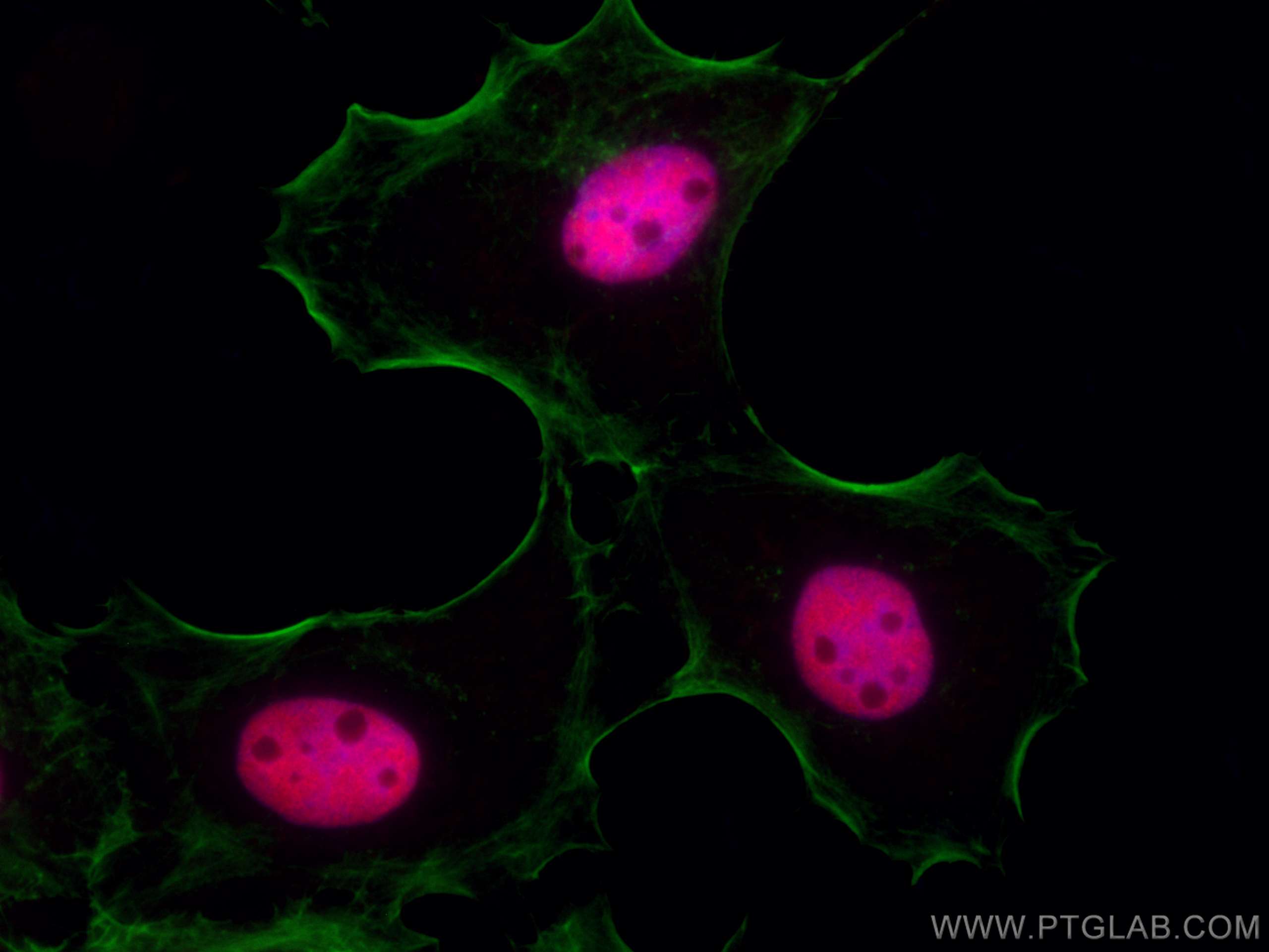 Immunofluorescence (IF) / fluorescent staining of A431 cells using CoraLite®594-conjugated P53 Polyclonal antibody (CL594-10442)