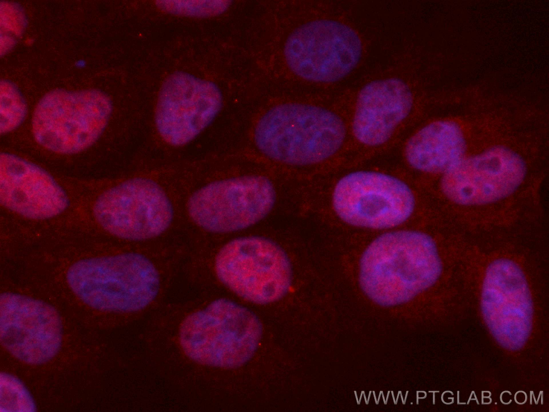 Immunofluorescence (IF) / fluorescent staining of A431 cells using CoraLite®594-conjugated P53 Monoclonal antibody (CL594-60283)