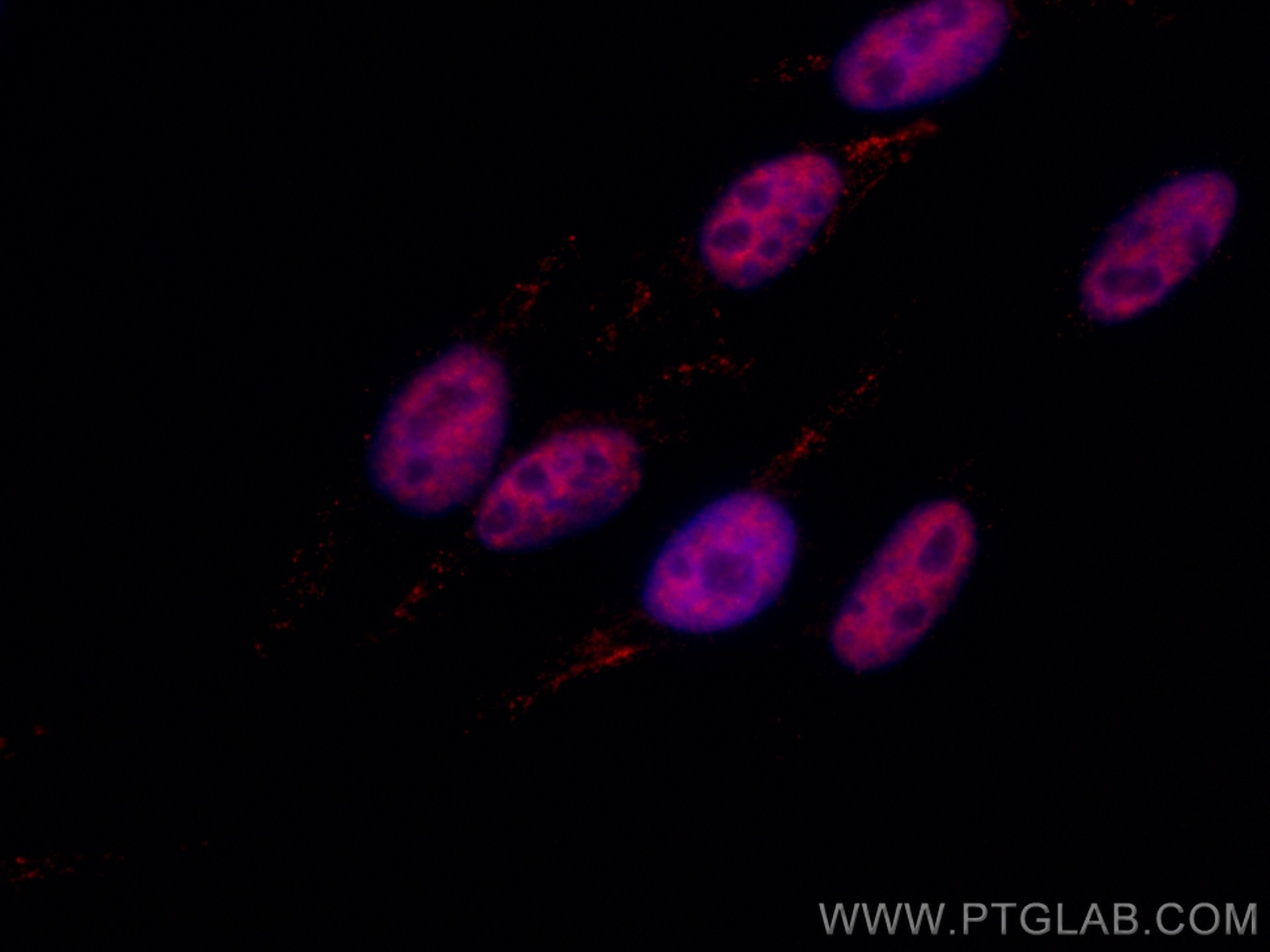 Immunofluorescence (IF) / fluorescent staining of HepG2 cells using CoraLite®594-conjugated P53 Recombinant antibody (CL594-80077)