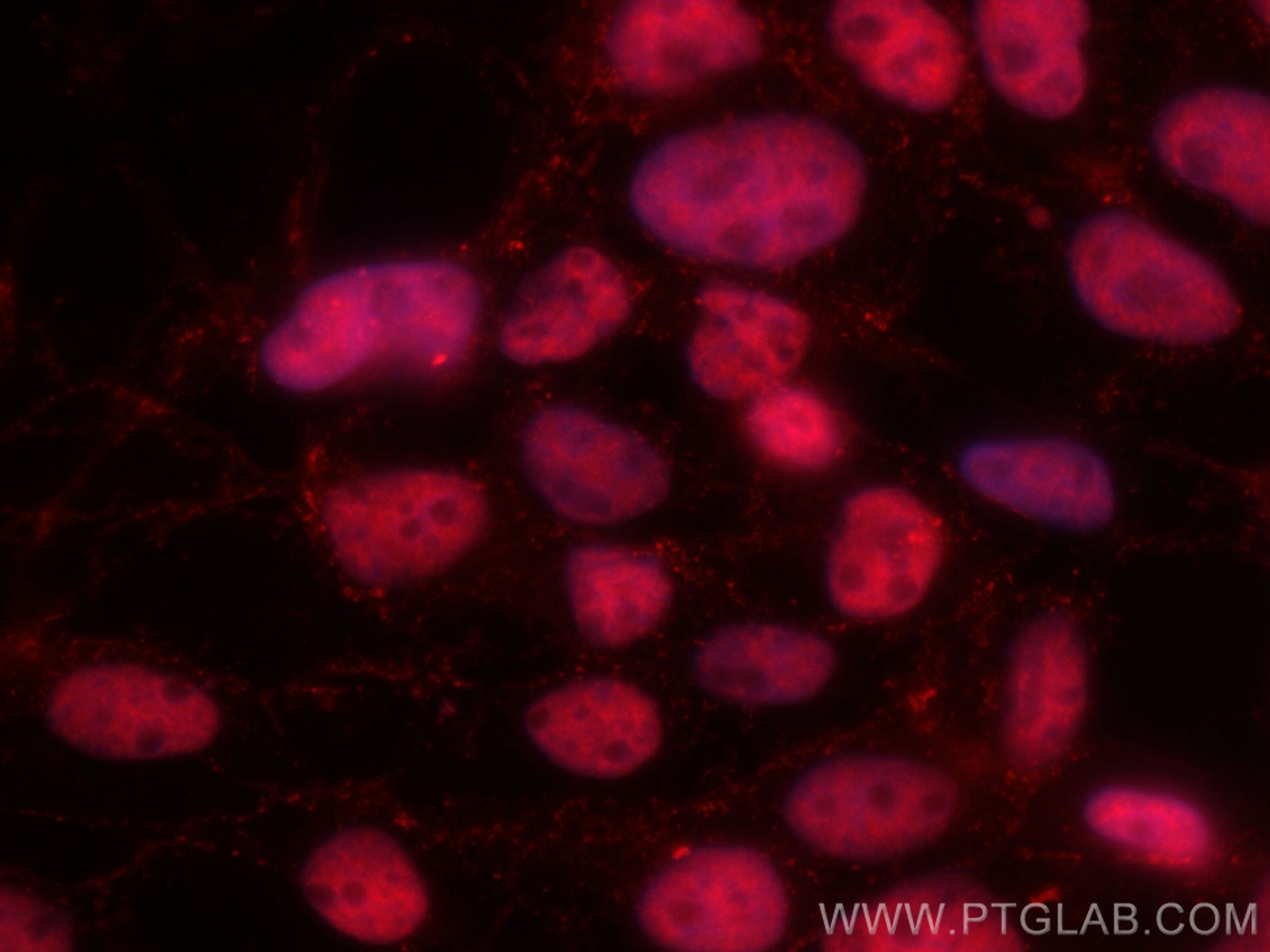 Immunofluorescence (IF) / fluorescent staining of A431 cells using CoraLite®594-conjugated P53 Recombinant antibody (CL594-80077)