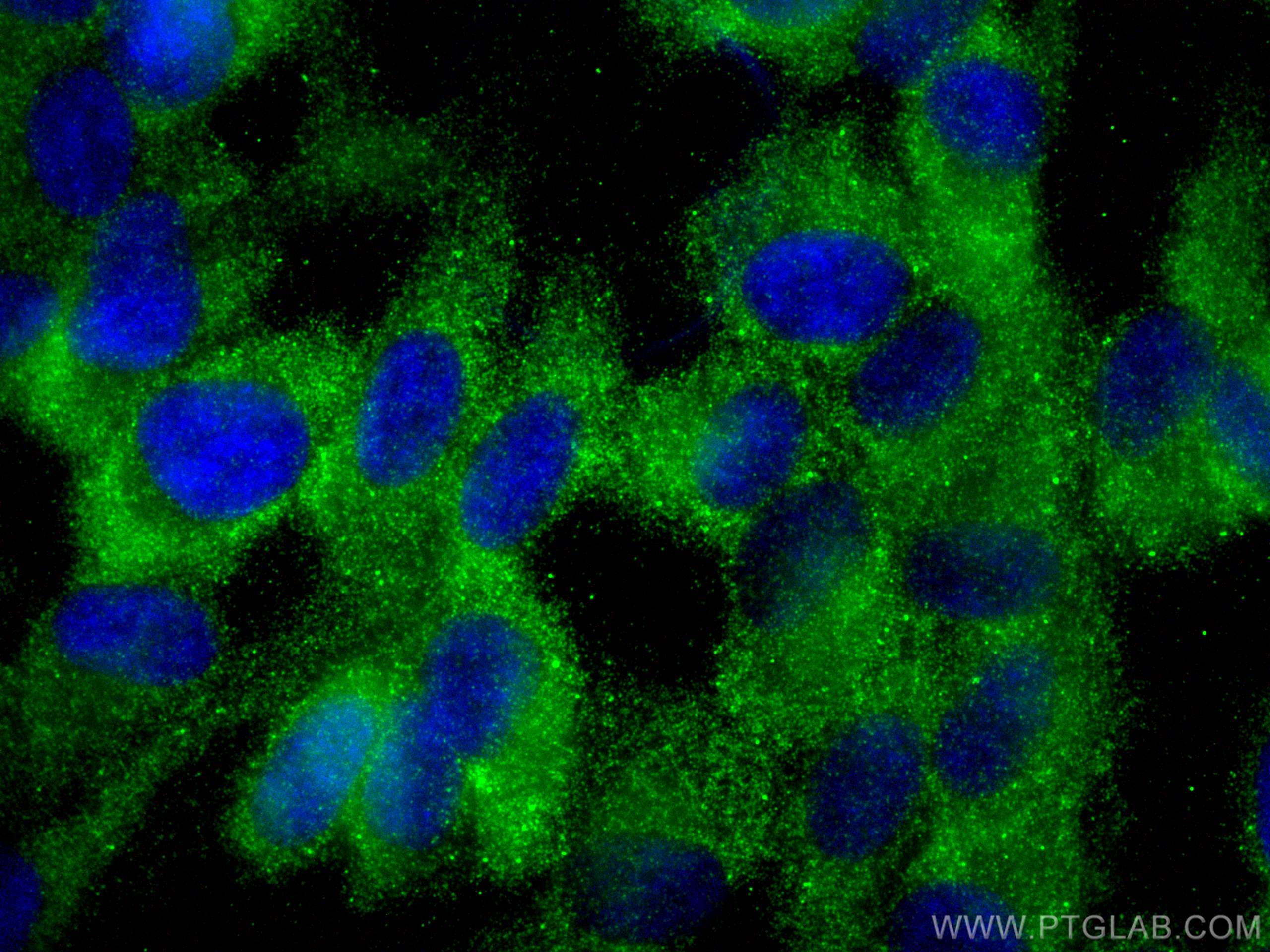 Immunofluorescence (IF) / fluorescent staining of hTERT-RPE1 cells using DDX6 Polyclonal antibody (14632-1-AP)