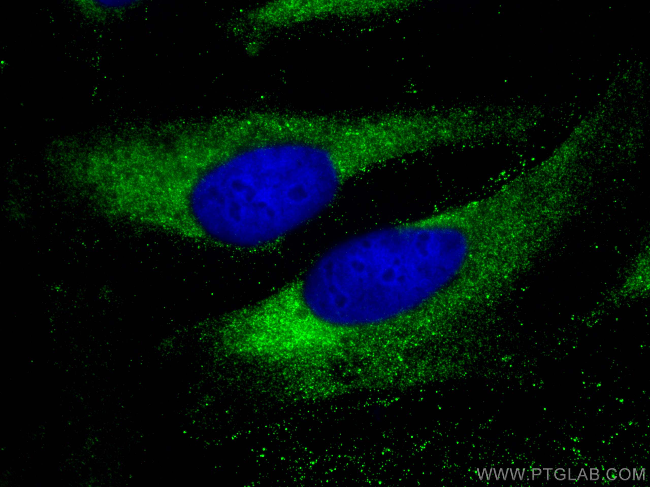 Immunofluorescence (IF) / fluorescent staining of HeLa cells using DDX6 Polyclonal antibody (14632-1-AP)