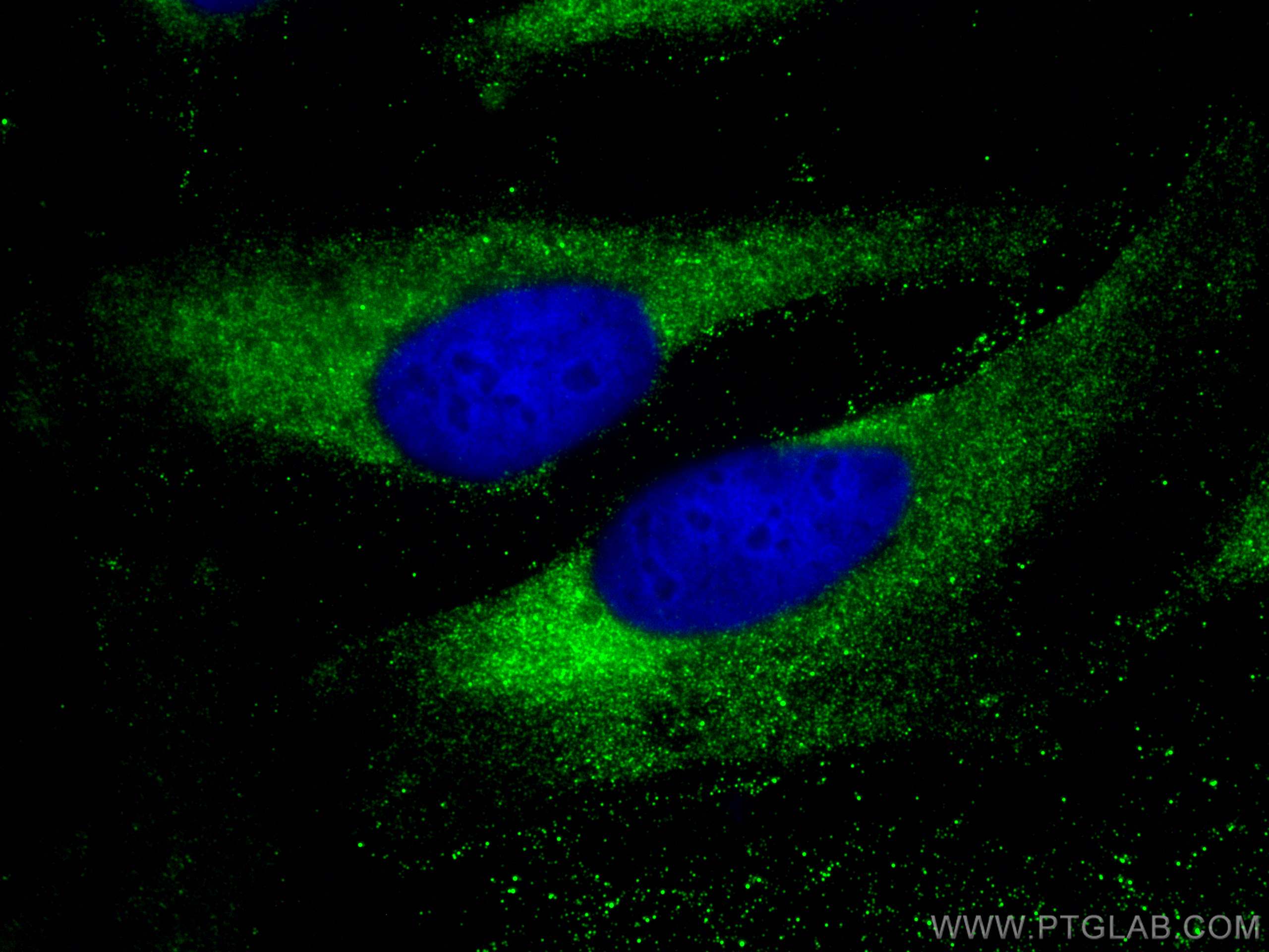 Immunofluorescence (IF) / fluorescent staining of HeLa cells using DDX6 Polyclonal antibody (14632-1-AP)