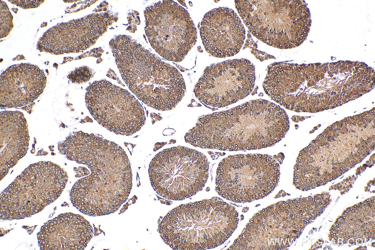Immunohistochemistry (IHC) staining of mouse testis tissue using DDX6 Polyclonal antibody (14632-1-AP)
