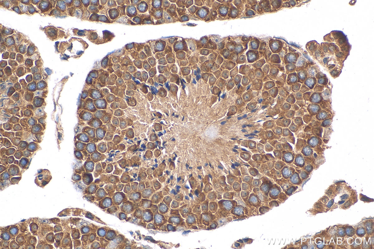 Immunohistochemistry (IHC) staining of mouse testis tissue using DDX6 Polyclonal antibody (14632-1-AP)