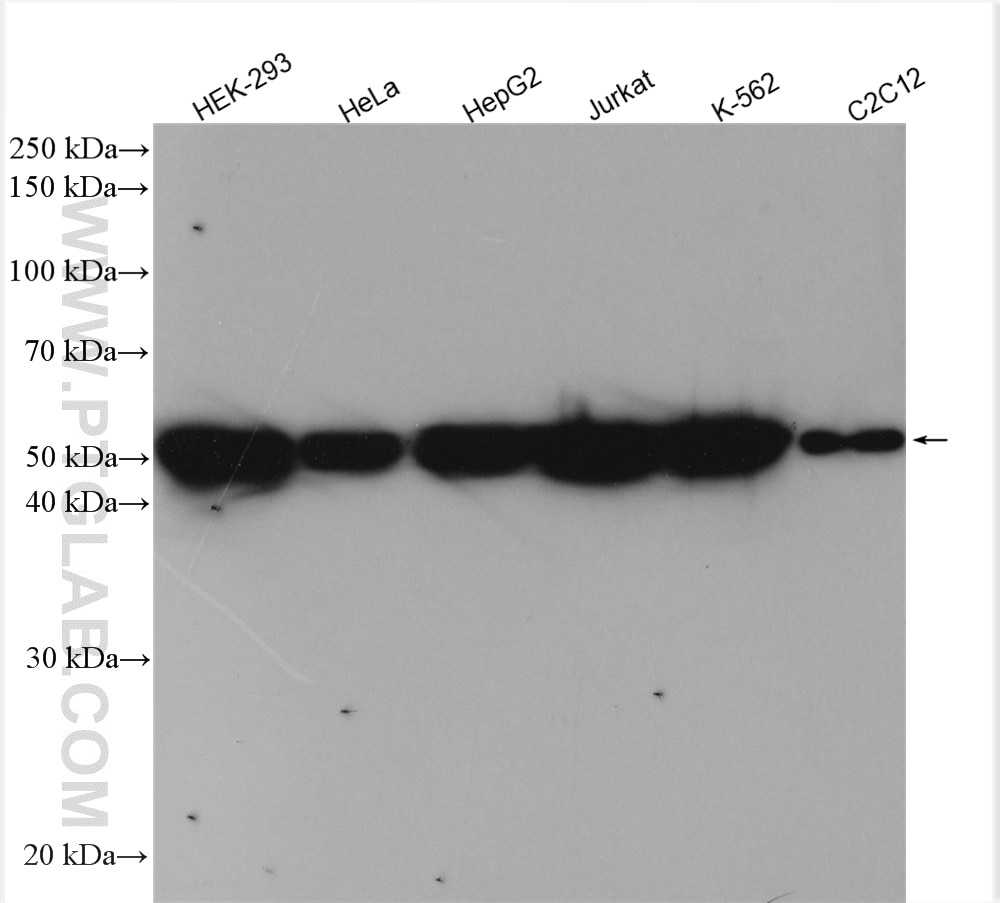 Western Blot (WB) analysis of various lysates using DDX6 Polyclonal antibody (14632-1-AP)