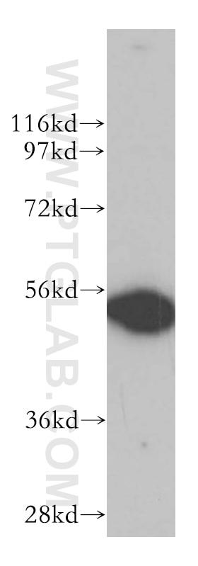 DDX6 Polyclonal antibody