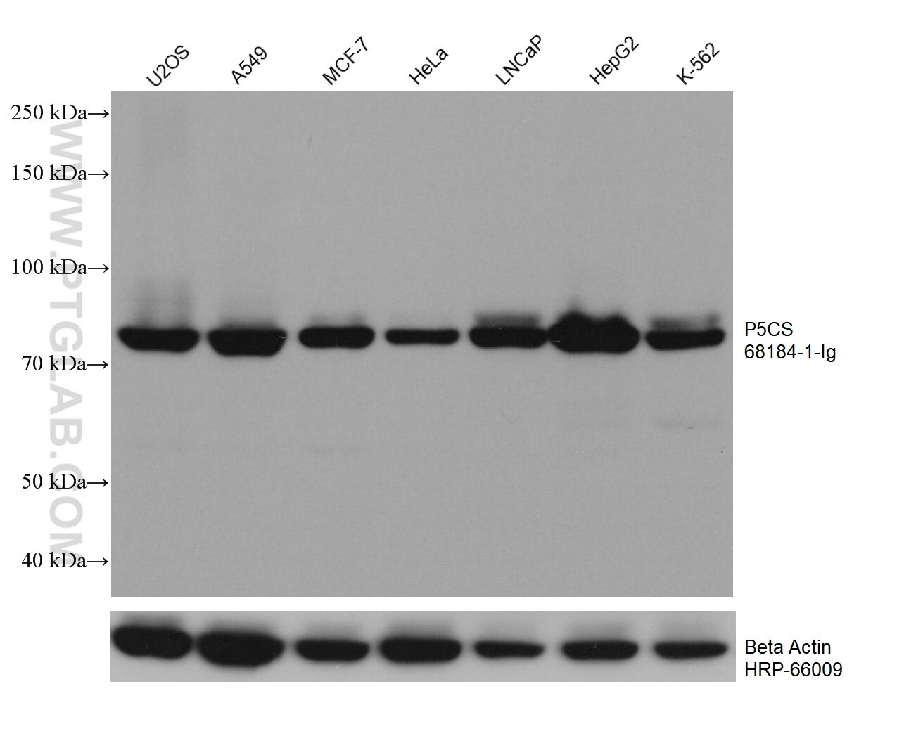 Western Blot (WB) analysis of various lysates using P5CS Monoclonal antibody (68184-1-Ig)