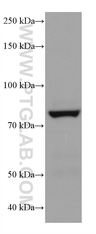Western Blot (WB) analysis of mouse colon tissue using P5CS Monoclonal antibody (68184-1-Ig)