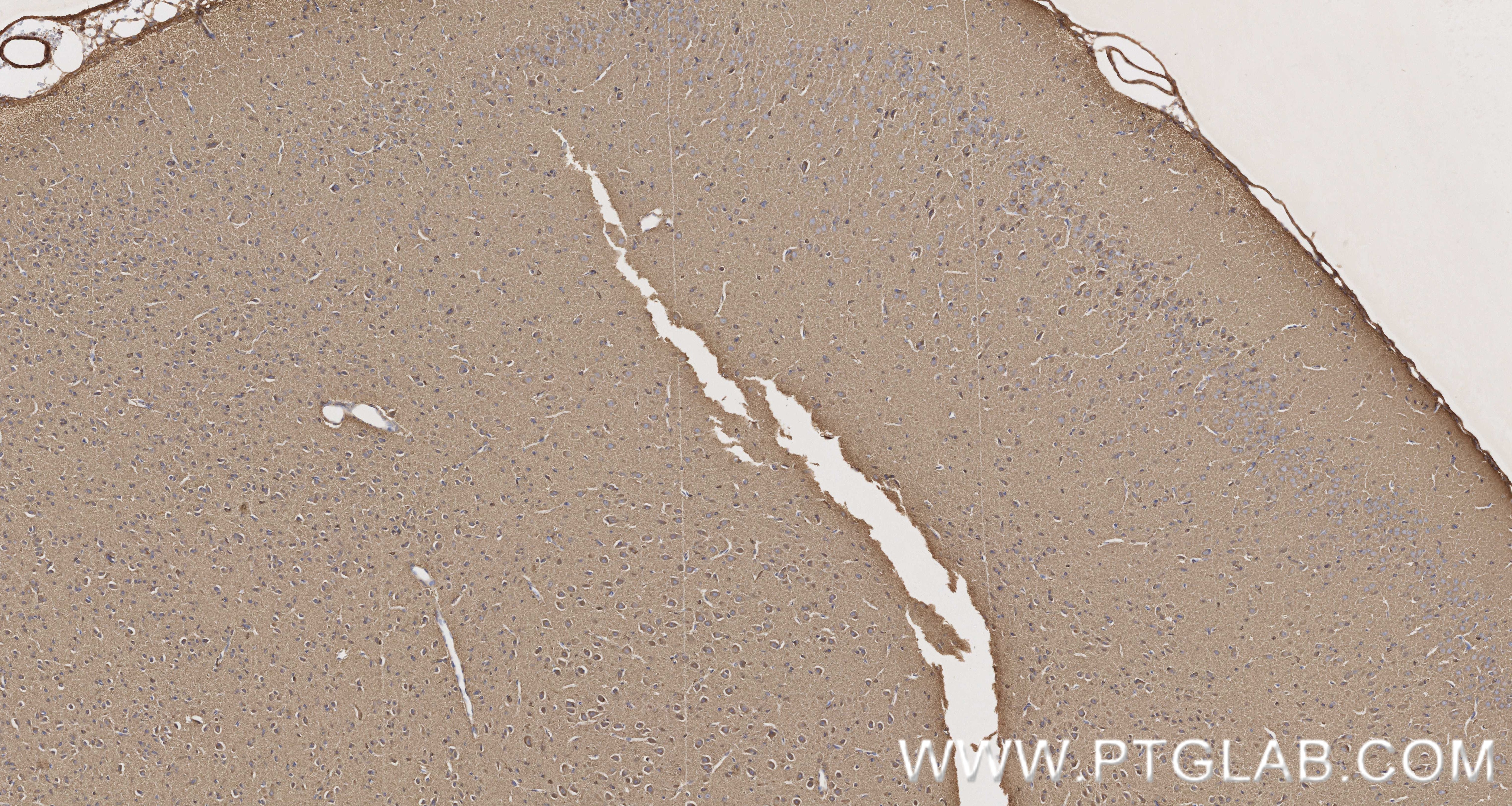 Immunohistochemical analysis of paraffin-embedded rat brain tissue slide using 87037-1-RR (P5CS antibody) at dilution of 1:1000 (under 10x lens). Heat mediated antigen retrieval with Tris-EDTA buffer (pH 9.0). This data was developed using the same antibody clone with 87037-1-PBS in a different storage buffer formulation. Immunohistochemistry (IHC) staining of rat brain tissue using P5CS Recombinant monoclonal antibody (87037-1-RR)