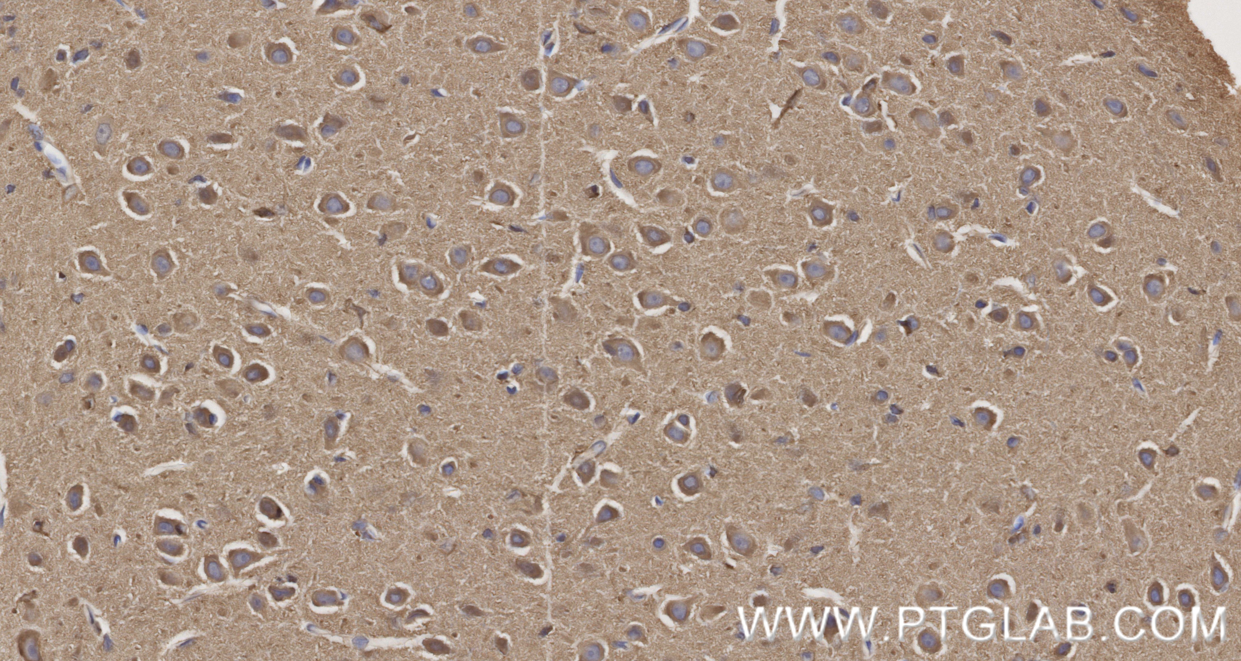 Immunohistochemical analysis of paraffin-embedded rat brain tissue slide using 87037-1-RR (P5CS antibody) at dilution of 1:1000 (under 40x lens). Heat mediated antigen retrieval with Tris-EDTA buffer (pH 9.0). This data was developed using the same antibody clone with 87037-1-PBS in a different storage buffer formulation. Immunohistochemistry (IHC) staining of rat brain tissue using P5CS Recombinant monoclonal antibody (87037-1-RR)