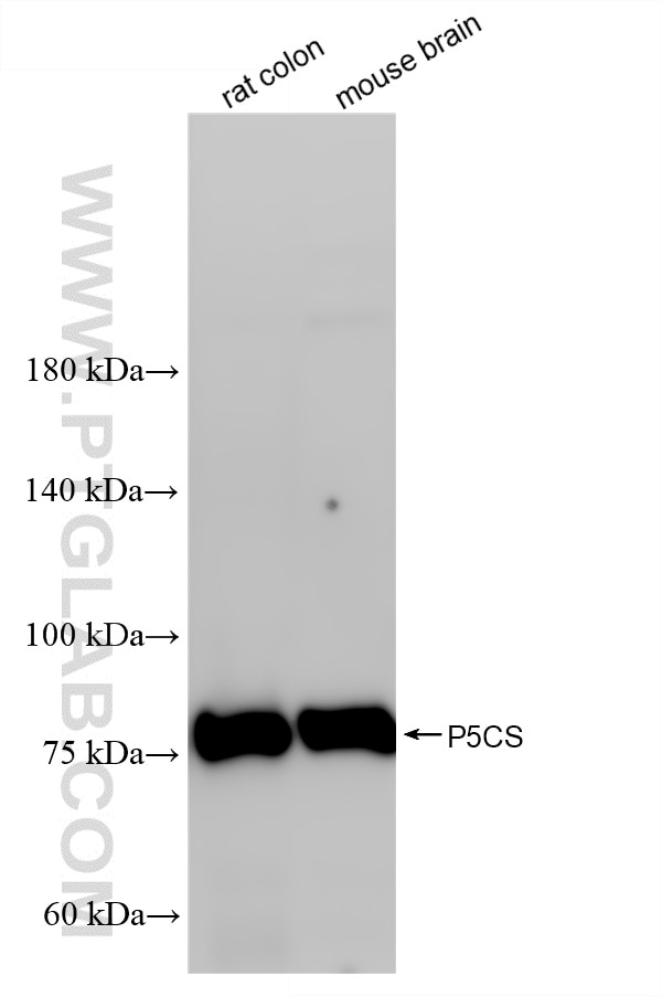 Various lysates were subjected to SDS PAGE followed by western blot with 87037-1-RR (P5CS antibody) at dilution of 1:10000 incubated at room temperature for 1.5 hours. This data was developed using the same antibody clone with 87037-1-PBS in a different storage buffer formulation. Western Blot (WB) analysis of various lysates using P5CS Recombinant monoclonal antibody (87037-1-RR)