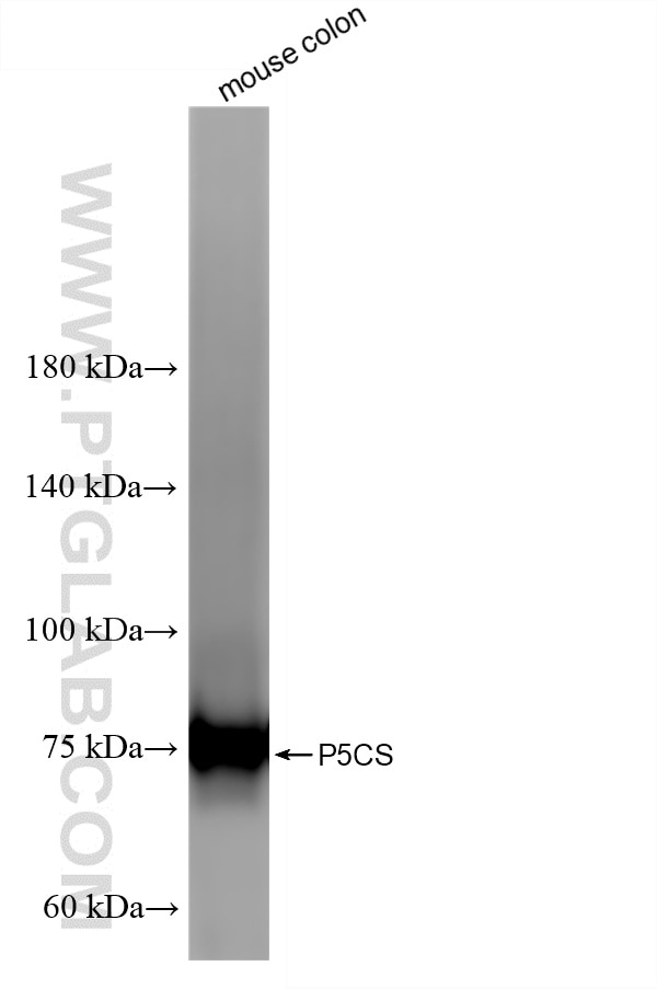 Mouse colon tissue were subjected to SDS PAGE followed by western blot with 87037-1-RR (P5CS antibody) at dilution of 1:10000 incubated at room temperature for 1.5 hours. This data was developed using the same antibody clone with 87037-1-PBS in a different storage buffer formulation. Western Blot (WB) analysis of various lysates using P5CS Recombinant monoclonal antibody (87037-1-RR)