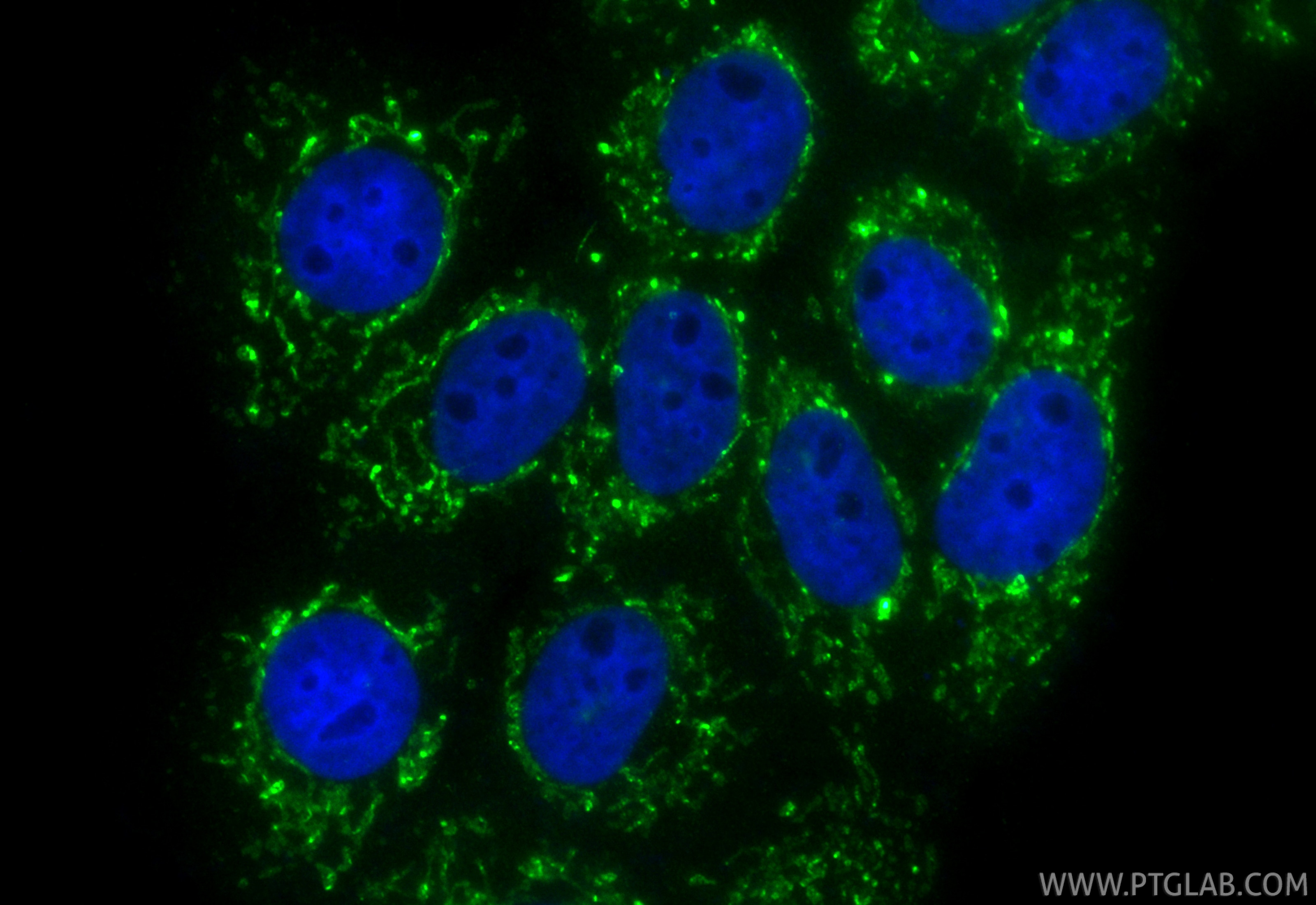 Immunofluorescence (IF) / fluorescent staining of A431 cells using CoraLite® Plus 488-conjugated P5CS Polyclonal anti (CL488-17719)
