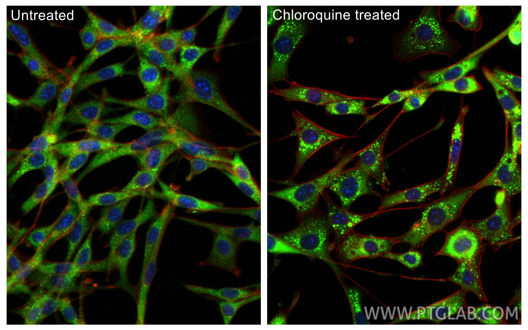 Immunofluorescent analysis of (-20°C Ethanol) fixed Chloroquine treated NIH/3T3 cells using P62/SQSTM1 antibody (31403-1-AP) at dilution of 1:200 and CoraLite®488-Conjugated Goat Anti-Rabbit IgG(H+L) (SA00013-2), CL594-phalloidin (red). Immunofluorescence (IF) / fluorescent staining of NIH/3T3 cells using P62/SQSTM1 Polyclonal antibody (31403-1-AP)