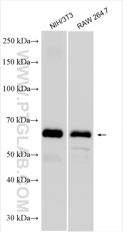 Western Blot (WB) analysis of various lysates using P62,SQSTM1 Polyclonal antibody (31403-1-AP)