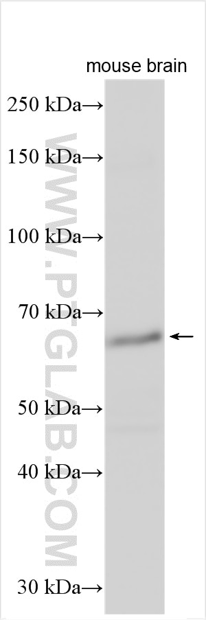 Western Blot (WB) analysis of various lysates using P62,SQSTM1 Polyclonal antibody (31403-1-AP)