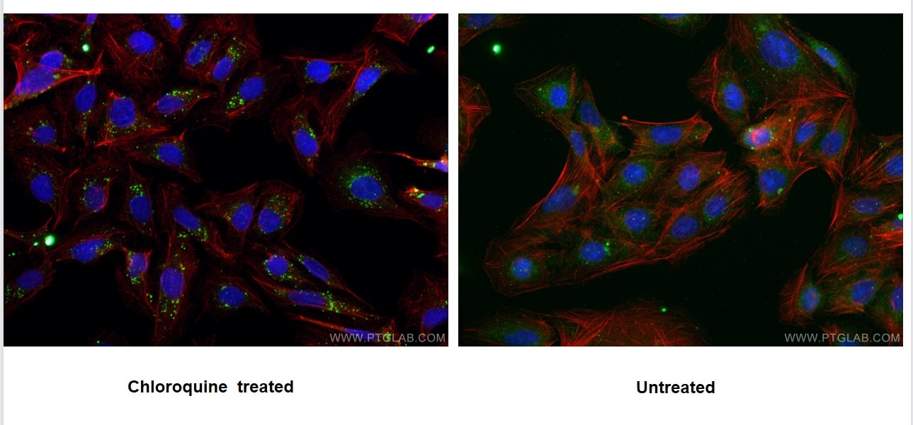 Immunofluorescence (IF) / fluorescent staining of U2OS cells using P62,SQSTM1 Monoclonal antibody (66184-1-Ig)